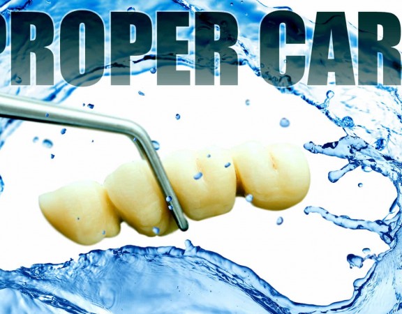 Tips for Cleaning Dental Bridge