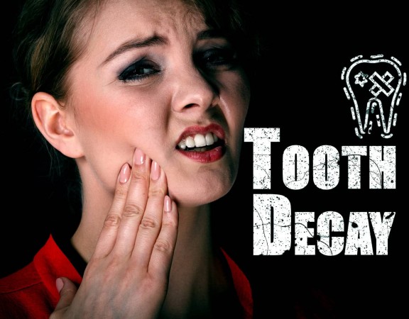 What is Tooth Decay