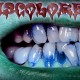 Discolored Tooth