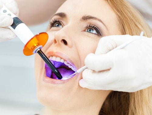 In office teeth whitening treatment