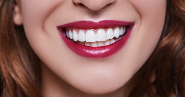 Popular Cosmetic Dentistry Trend